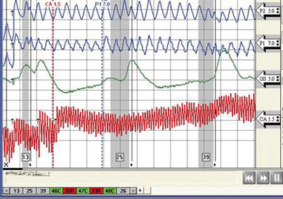 Best Sacramento polygraph test